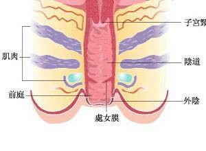 阴道口局部红肿热痛