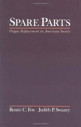 Spare Parts