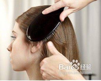 头皮型银屑病