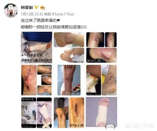 “蹦床公主
