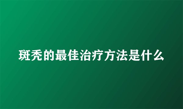 斑秃的最佳治疗方法是什么