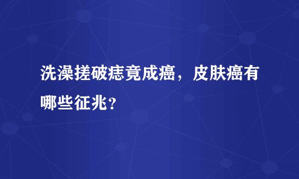 洗澡搓破痣竟成癌，皮肤癌有哪些征兆？