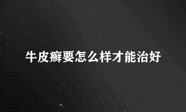 牛皮癣要怎么样才能治好