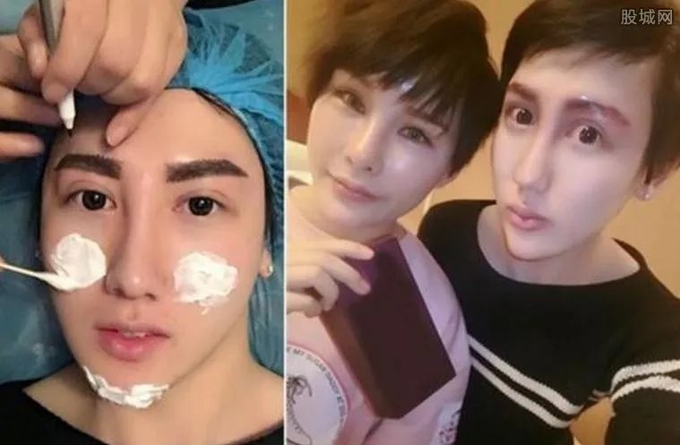 刘梓晨整容前后照片 刘梓晨为什么要整容?