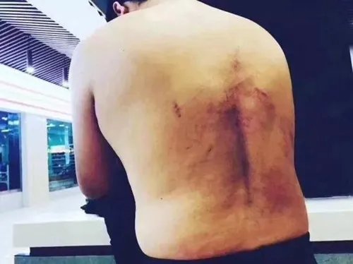 记者被关太平间已伤痕累累    其被袭击原因令人大吃一惊！