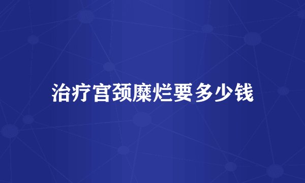 治疗宫颈糜烂要多少钱