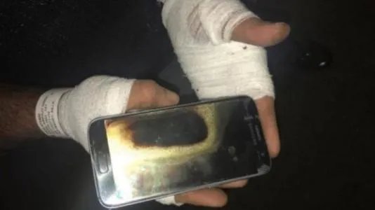 三星回应男子手机爆炸被烧伤，难道真的是三星手机的质量问题？