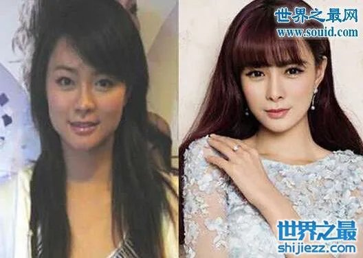 沈梦辰整容对比图,整容前后村姑变女神差太多