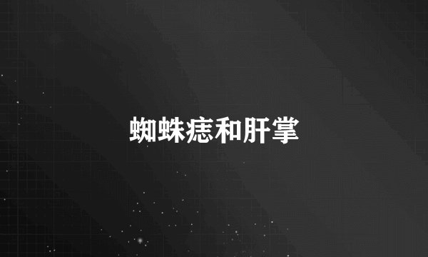 蜘蛛痣和肝掌