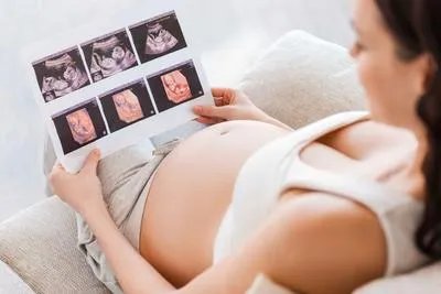 四维彩超什么时候做最好 介绍做四维彩超的最佳三个时期