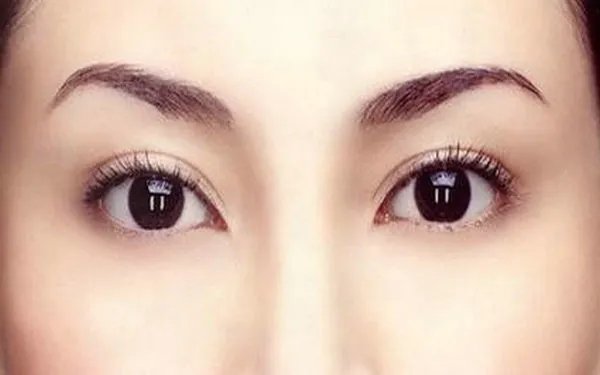 韩式提眉术的效果怎么样呢？