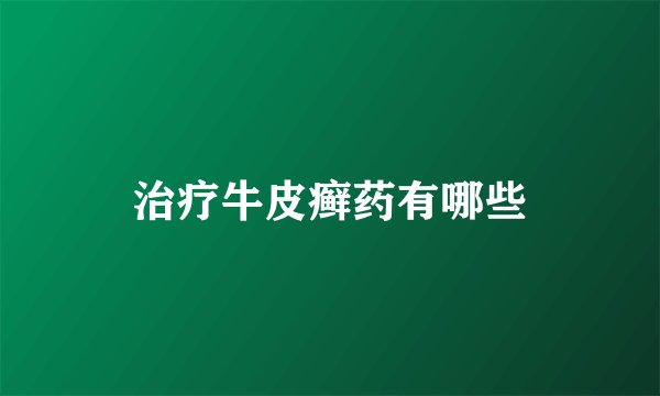 治疗牛皮癣药有哪些