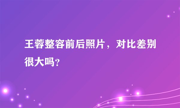 王蓉整容前后照片，对比差别很大吗？