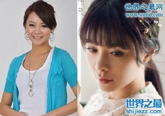 沈梦辰整容对比图,整容前后村姑变女神差太多