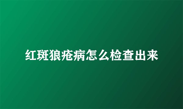 红斑狼疮病怎么检查出来