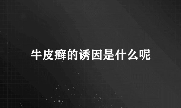 牛皮癣的诱因是什么呢