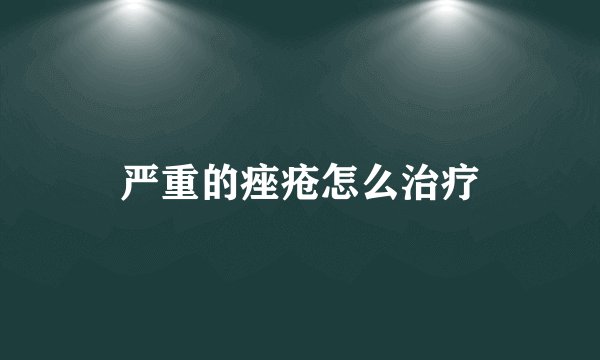 严重的痤疮怎么治疗
