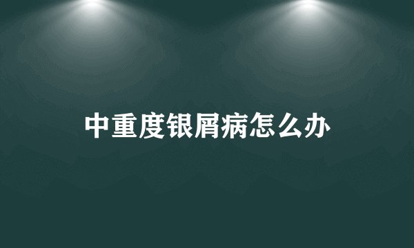 中重度银屑病怎么办