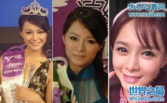 沈梦辰整容对比图,整容前后村姑变女神差太多