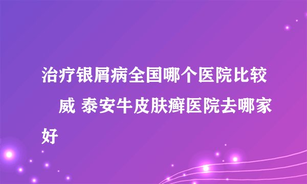 治疗银屑病全国哪个医院比较權威 泰安牛皮肤癣医院去哪家好