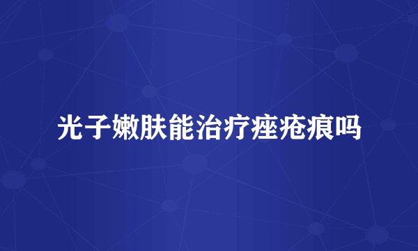 光子嫩肤能治疗痤疮痕吗