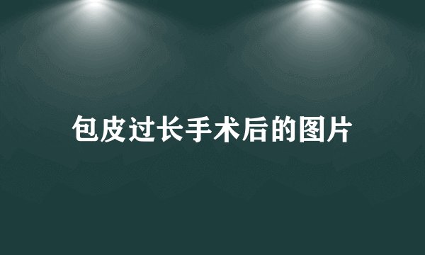 包皮过长手术后的图片
