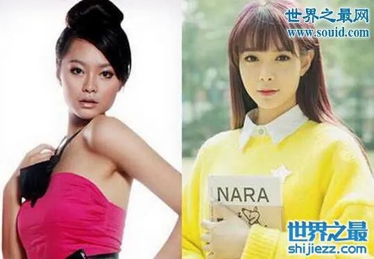 沈梦辰整容对比图,整容前后村姑变女神差太多