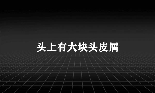 头上有大块头皮屑
