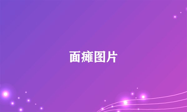 面瘫图片
