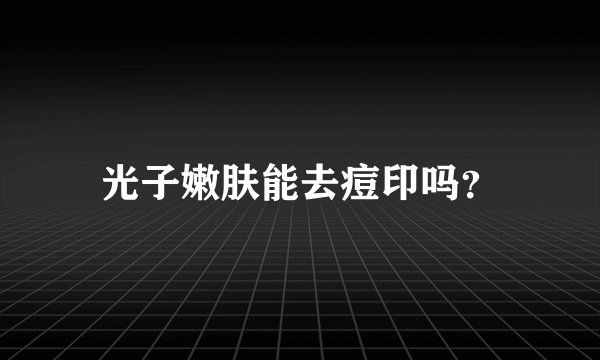 光子嫩肤能去痘印吗？