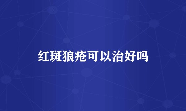 红斑狼疮可以治好吗