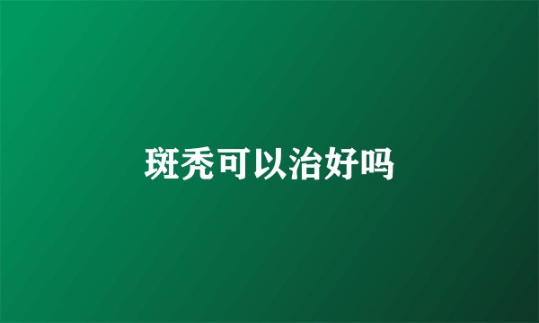 斑秃可以治好吗