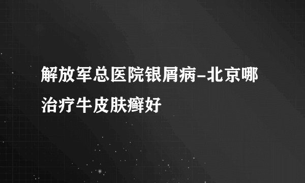 解放军总医院银屑病-北京哪治疗牛皮肤癣好