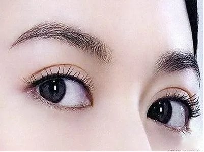 开内眼角好么