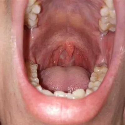 咳痰是怎么引起的?