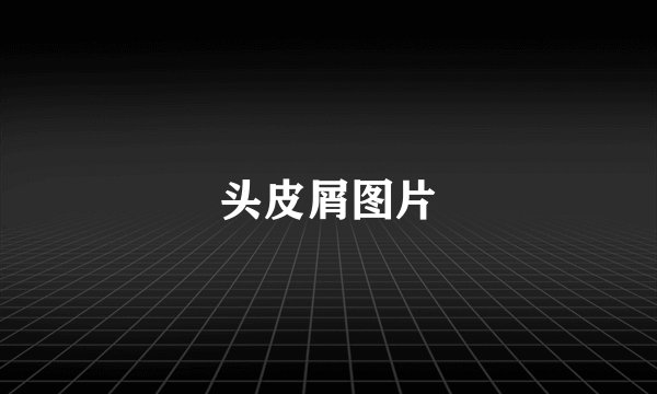 头皮屑图片