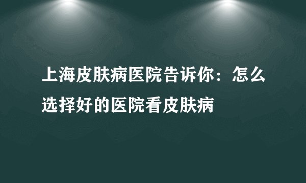 上海皮肤病医院告诉你：怎么选择好的医院看皮肤病