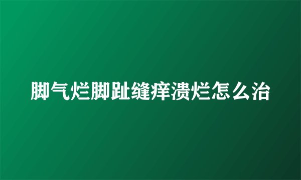 脚气烂脚趾缝痒溃烂怎么治