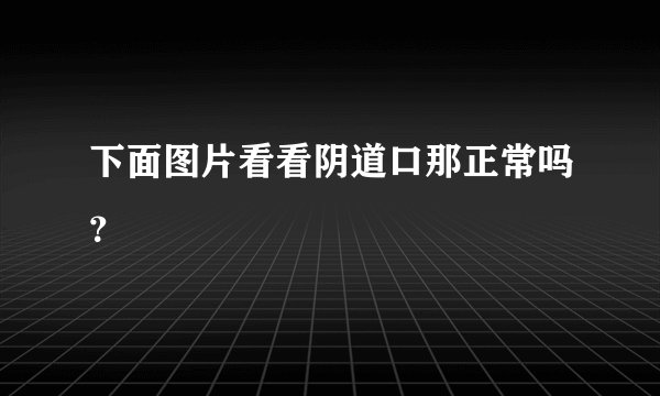 下面图片看看阴道口那正常吗？