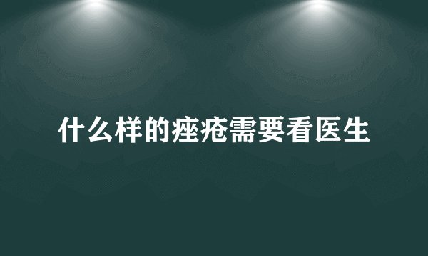 什么样的痤疮需要看医生