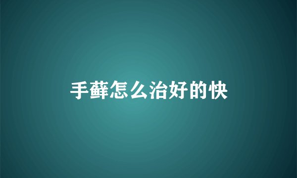手藓怎么治好的快