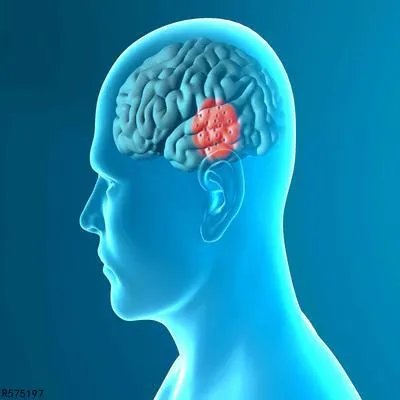 脑栓塞怎么预防 预防脑栓塞的3个方法分享