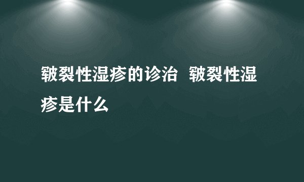 皲裂性湿疹的诊治  皲裂性湿疹是什么