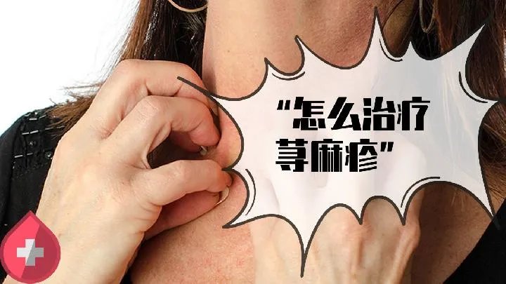 荨麻疹有哪些症状表现