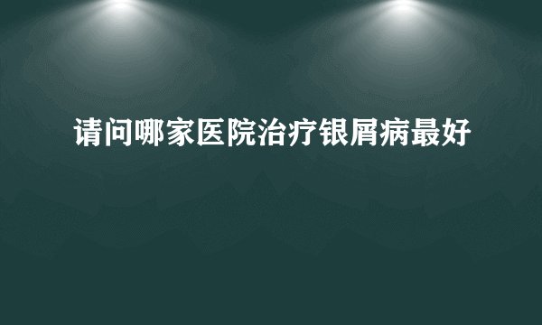 请问哪家医院治疗银屑病最好