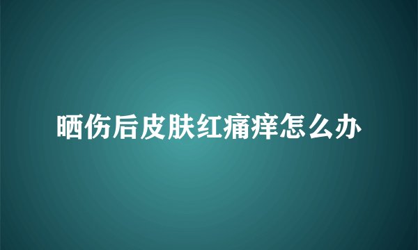 晒伤后皮肤红痛痒怎么办