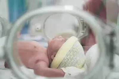 新生儿泪腺炎注意什么 新生儿泪腺炎需注意五个事项