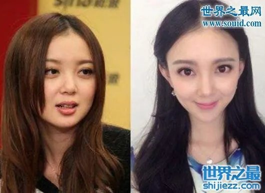 汪小敏整容前后照片对比,大饼脸变宅男女神
