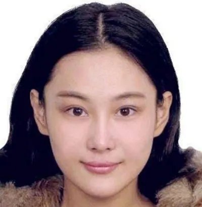 张馨予整过容吗？整容前后照片差别惊人