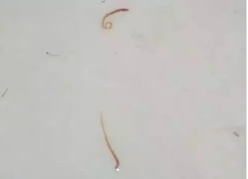 女子洗澡时从花洒冲出红色活虫,蜷缩扭动形似蚯蚓,对身体是否会有伤害?